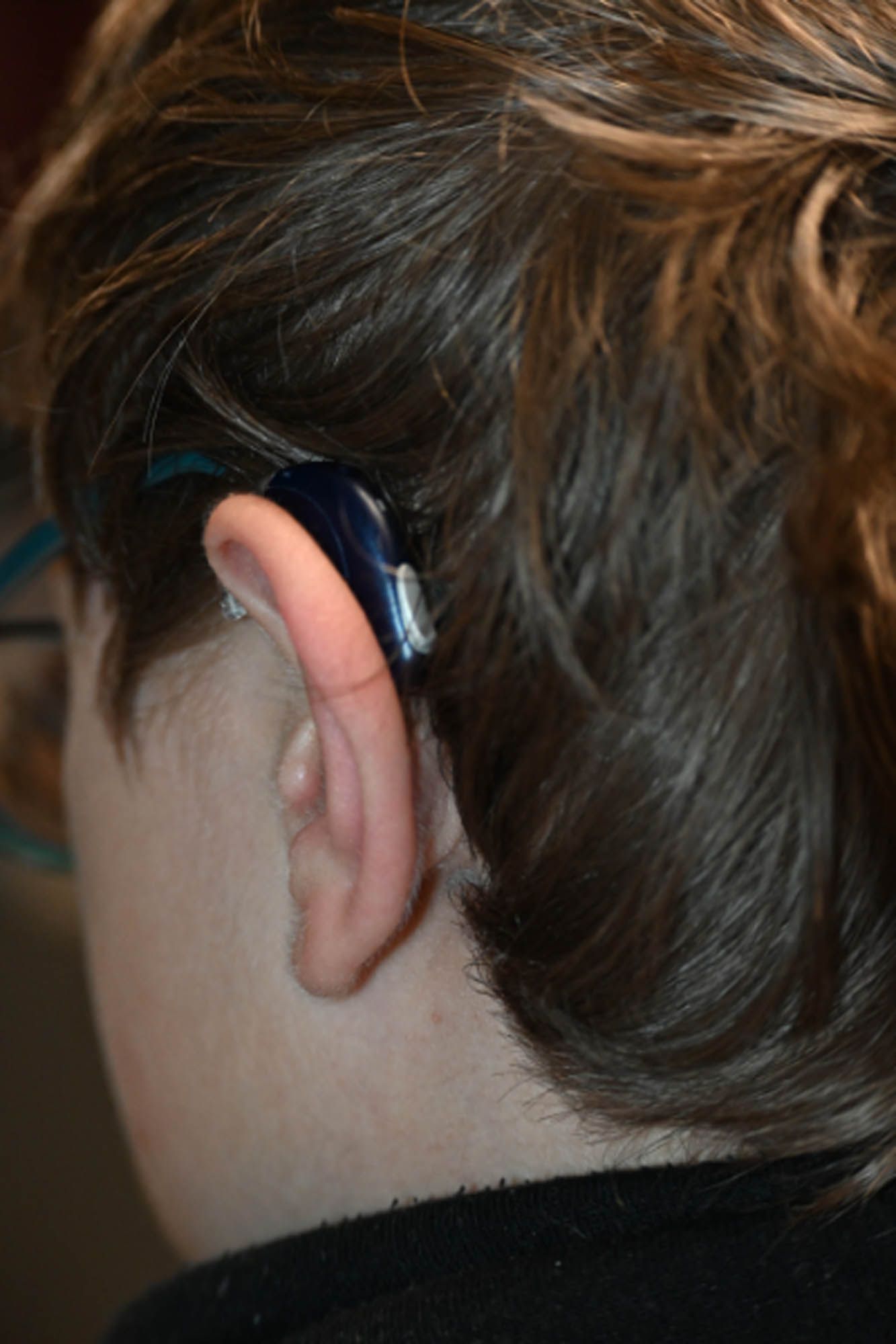 Eine Nahaufnahme des Ohrs einer Person mit einem Hörgerät.