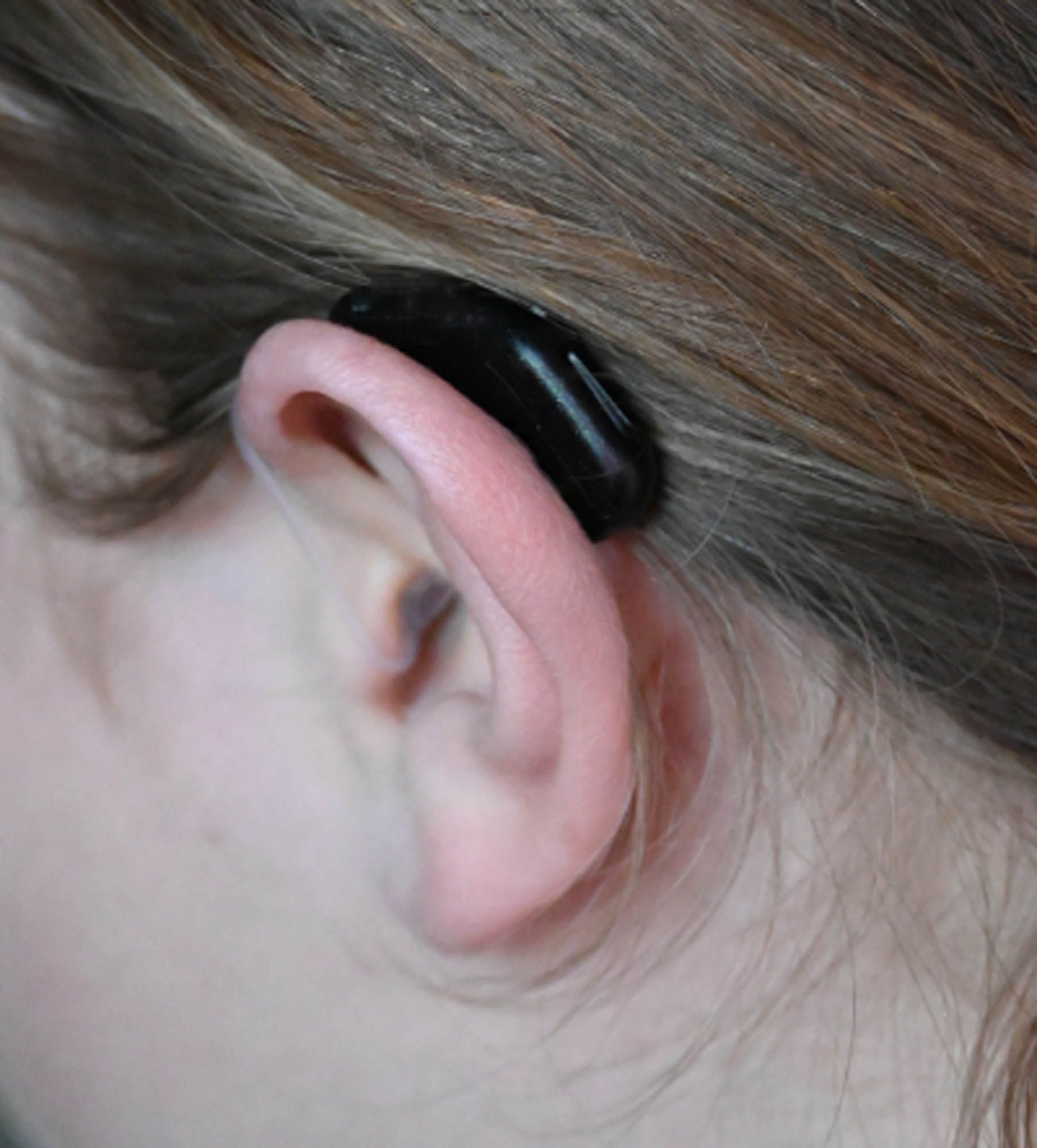 Eine Nahaufnahme des Ohrs einer Person mit einem Hörgerät darin.