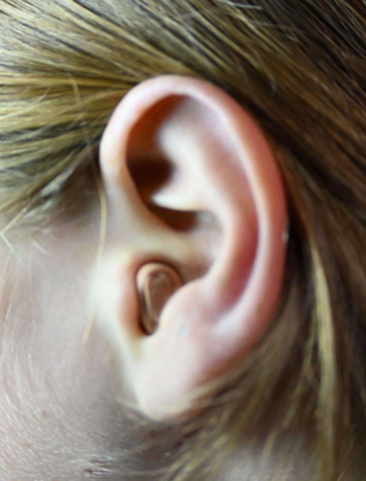 Eine Nahaufnahme eines menschlichen Ohrs mit Haaren