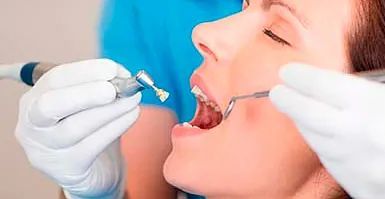 Una mujer está siendo examinada por un dentista.