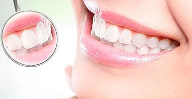 Una mujer sonríe y mira sus dientes en un espejo.