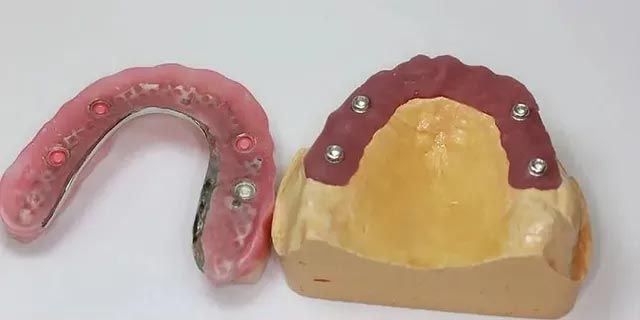Un modelo de un diente y un modelo de una dentadura postiza sobre una mesa.