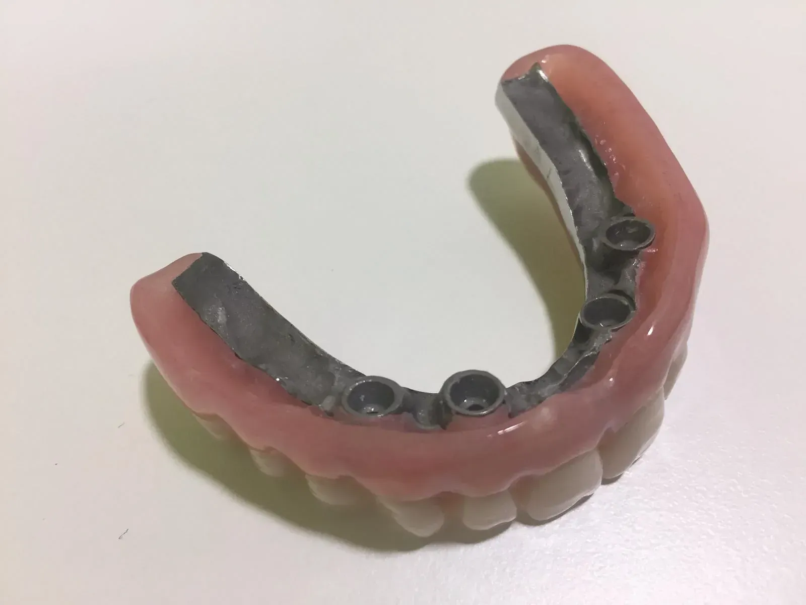 Un primer plano de una dentadura postiza sobre una superficie blanca.