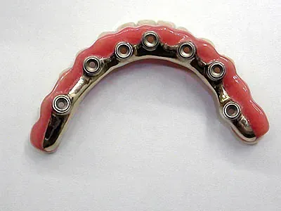 Un primer plano de un implante dental sobre una superficie blanca.