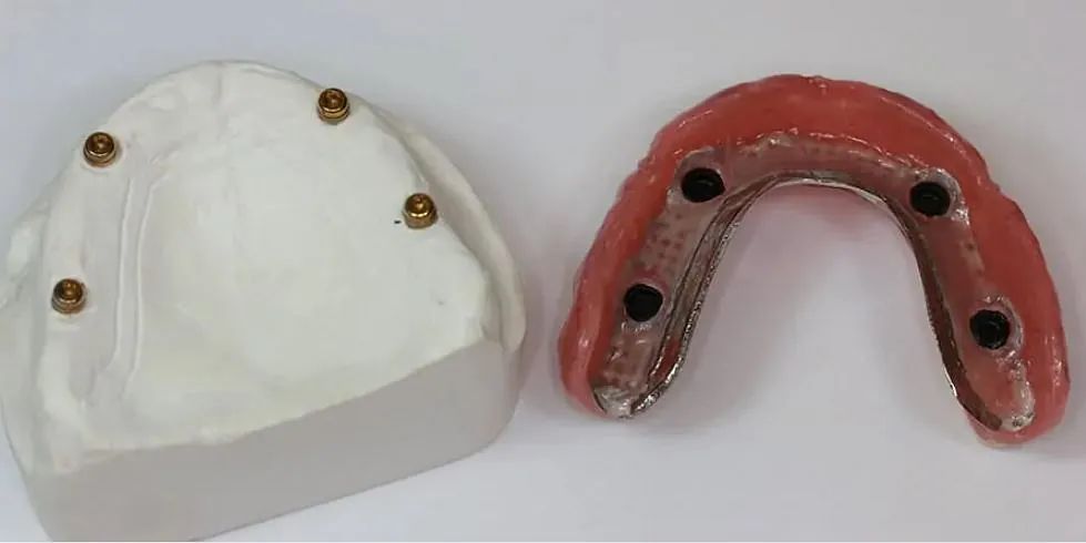 Un modelo de una dentadura postiza y una dentadura sobre una superficie blanca.