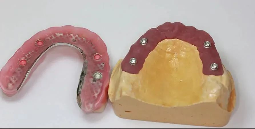 Un modelo de un diente y un modelo de una dentadura postiza sobre una mesa.
