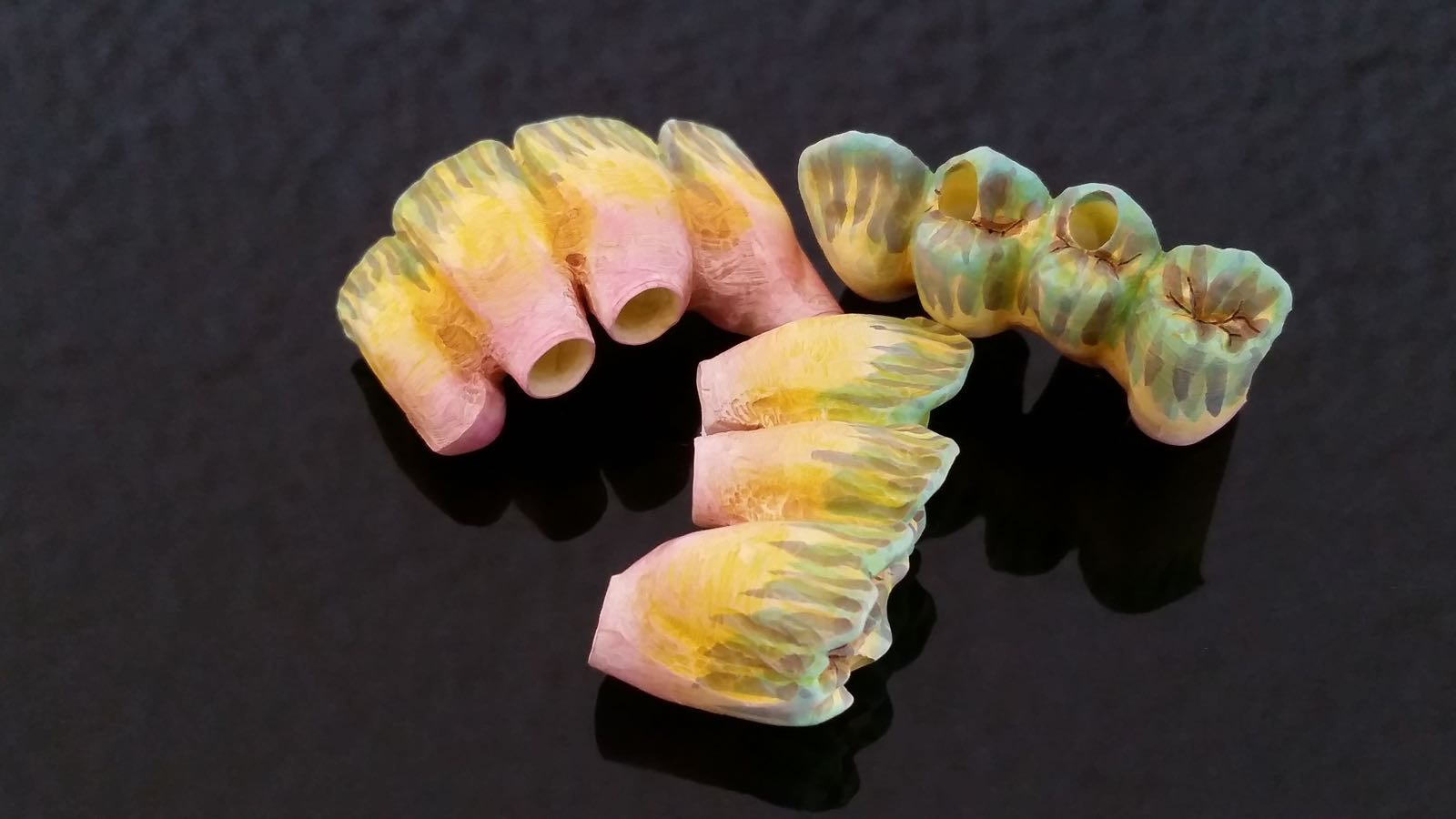 Zahnprotesen Zahnersatz - dental moeschli.ch Basel