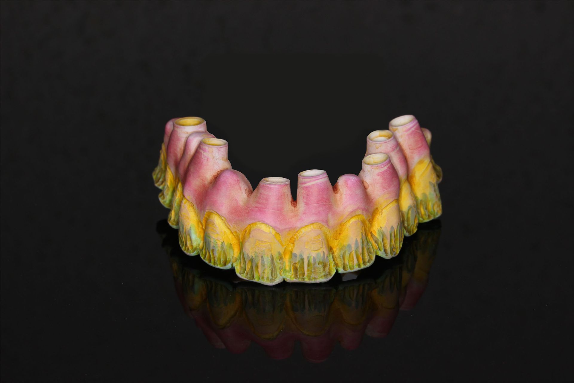 Zahnprotesen Zahnersatz - dental moeschli.ch Basel