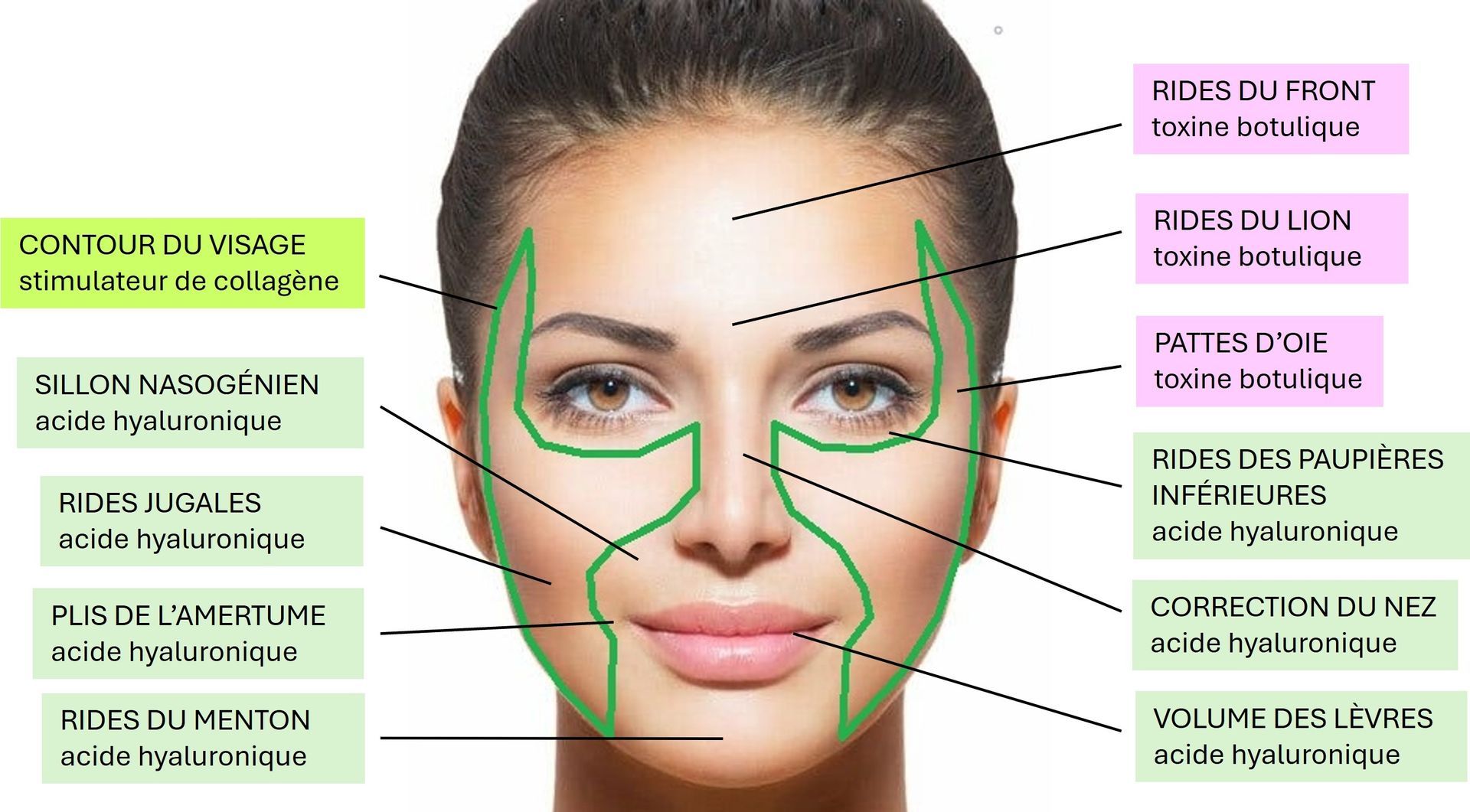 Visage annoté montrant les groupes musculaires faciaux et leurs étiquettes en français sur fond blanc