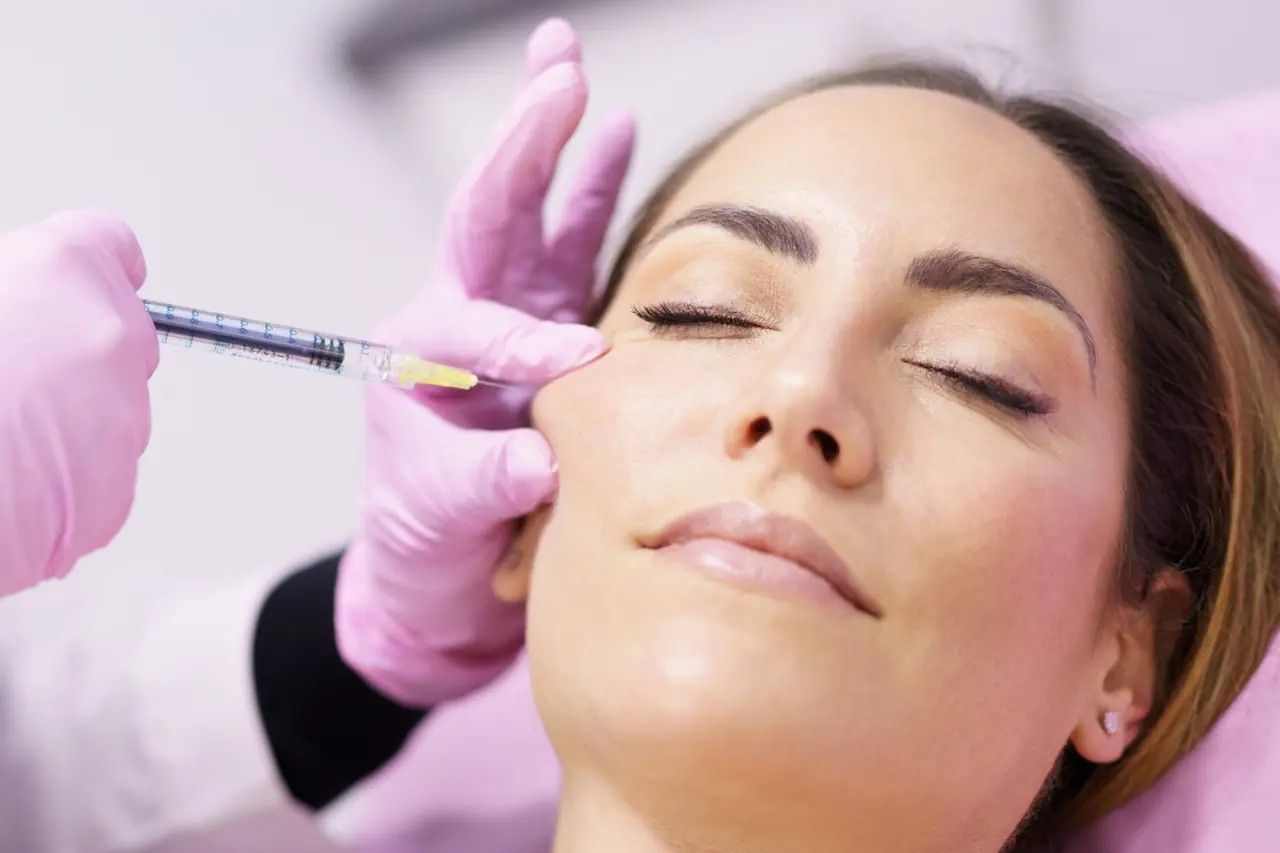 Procédure esthétique consistant à injecter un produit dans la joue d'une femme à l'aide d'une seringue, les mains gantées.
