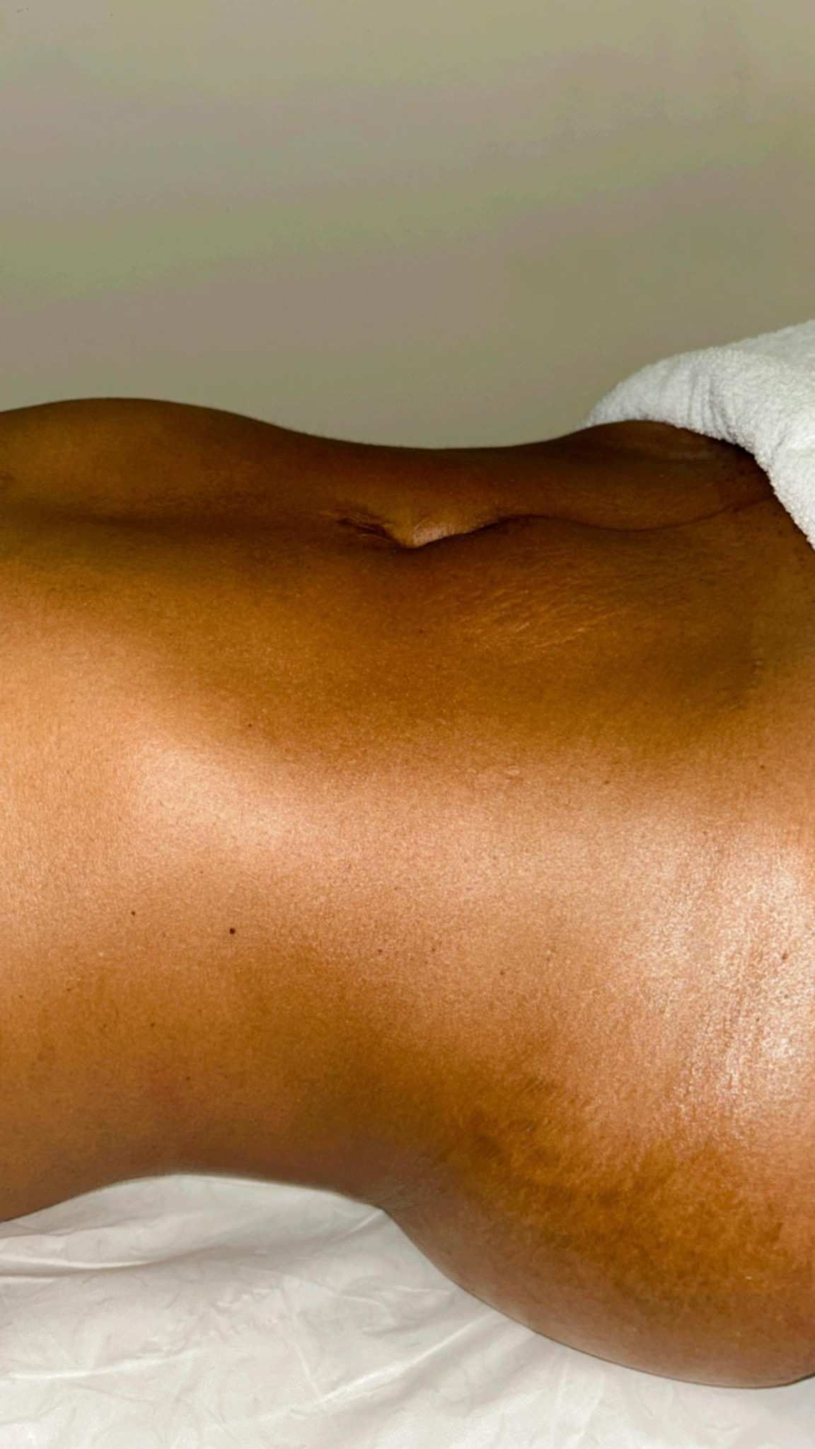 Tratamiento facial antes y después; mujer con la piel más clara y luminosa. Un lado muestra la piel más áspera, el otro, más suave.