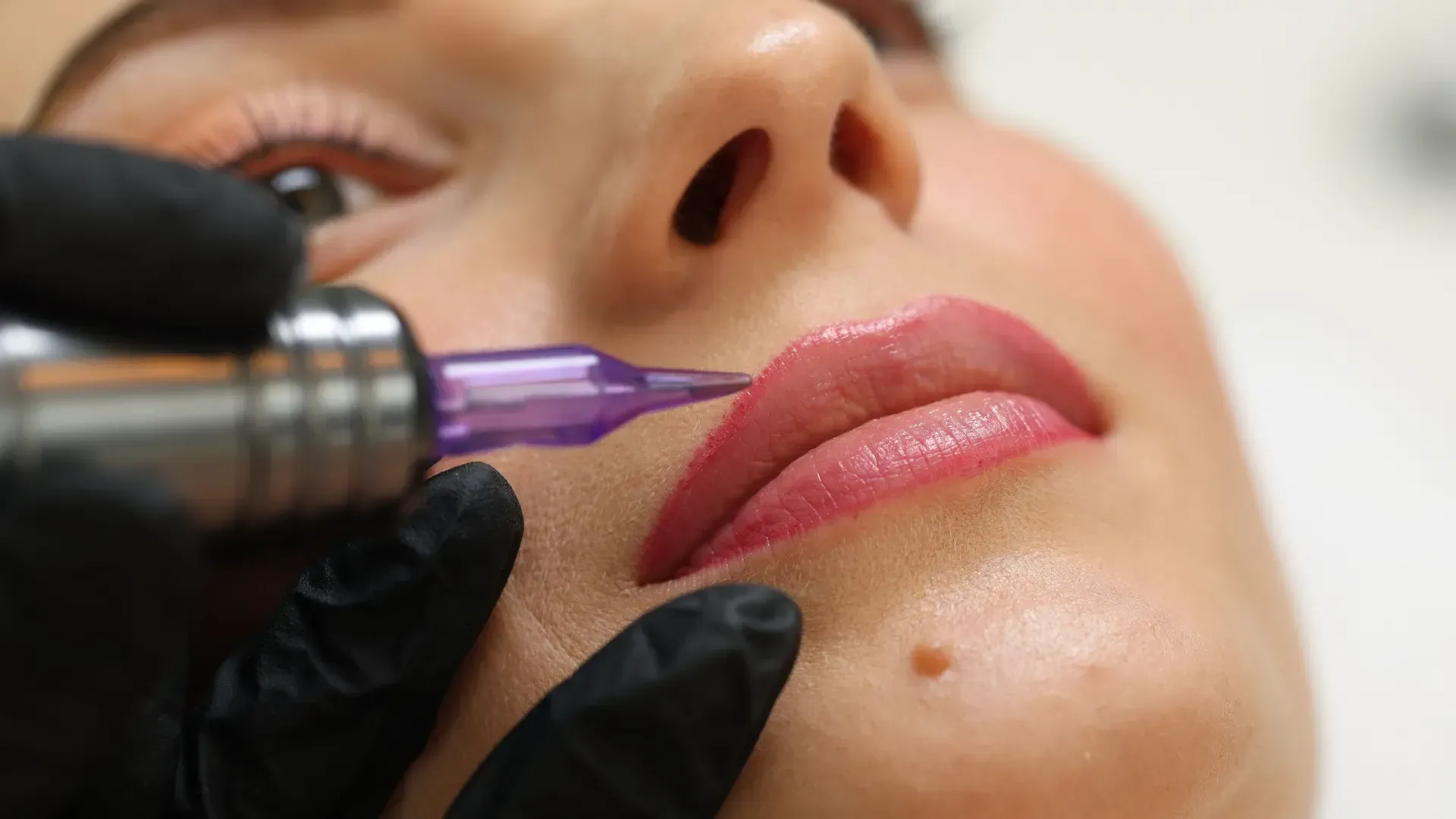 Procedimiento de tatuaje cosmético con rubor de labios en el labio de una persona utilizando un bolígrafo para tatuajes con punta violeta.
