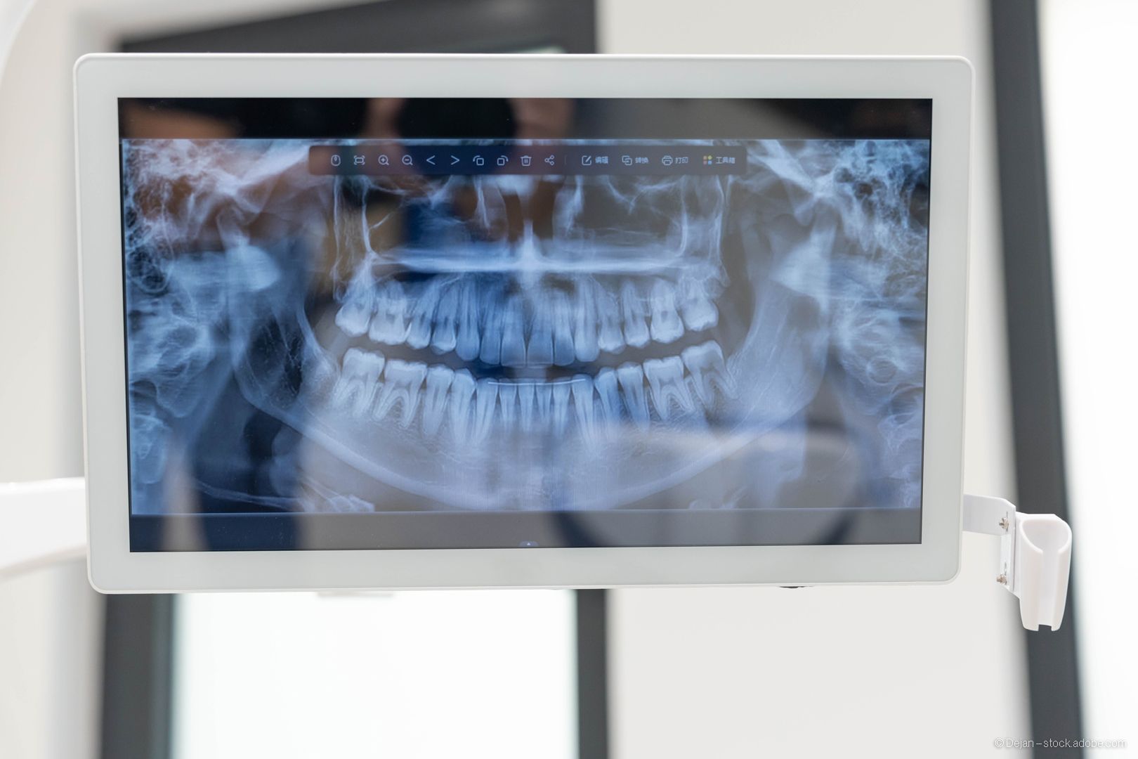 Ein Röntgenbild der Zähne  hilft Zahnärzten, die Zahngesundheit des Patienten für die Diagnose zu beurteilen