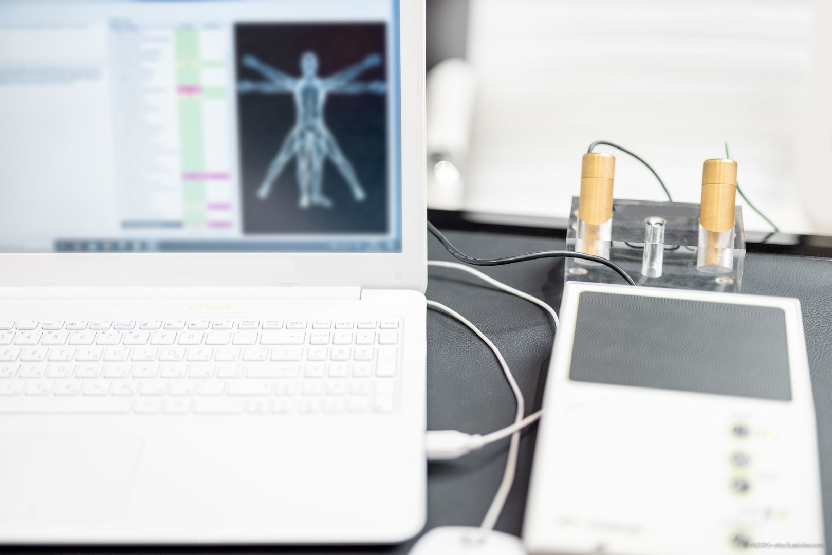 Bioenergetisches Testgerät mit Messinghandstücken und Diagnoseergebnissen auf dem Computerbildschirm in einer Klinik