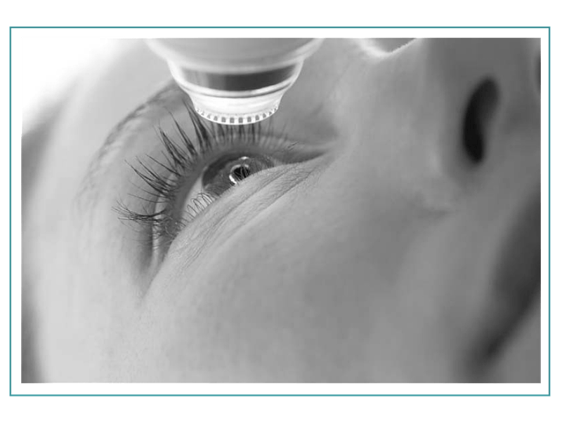 Opération réfractive Opération réfractive