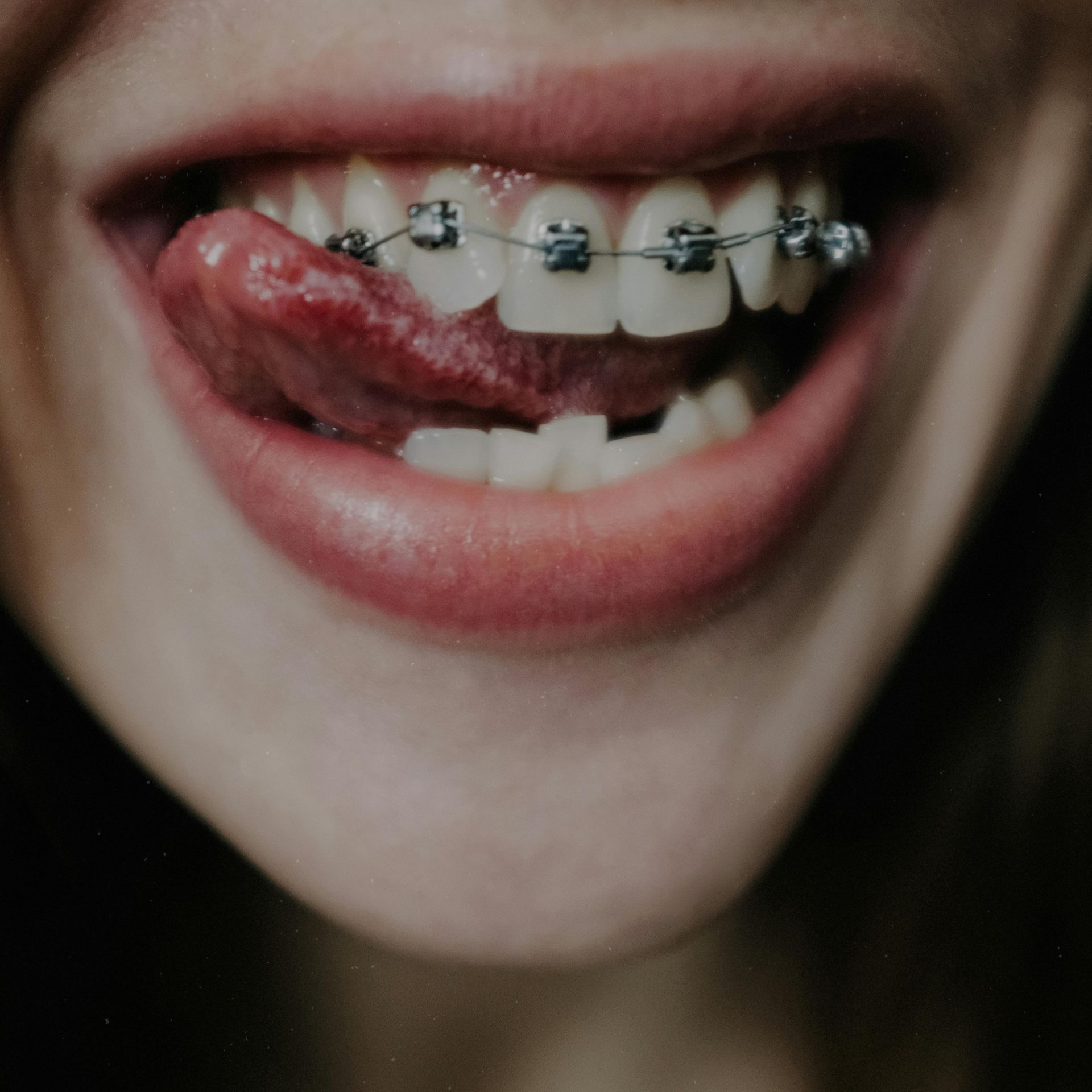 متابعة علاج تقويم الأسنان بشكل دوري