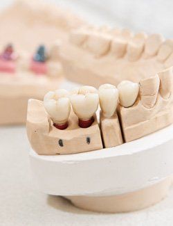 Zahnarztpraxis Robert Gutowski – Zahnmodell