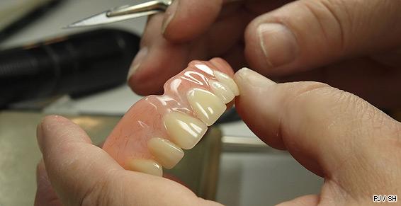 Fabrication de prothèses dentaires