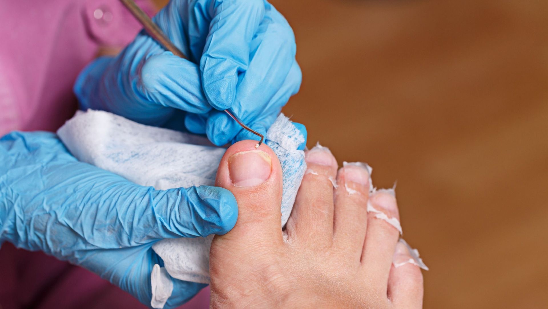 Una persona se está haciendo cortar las uñas de los pies con un técnico de uñas.