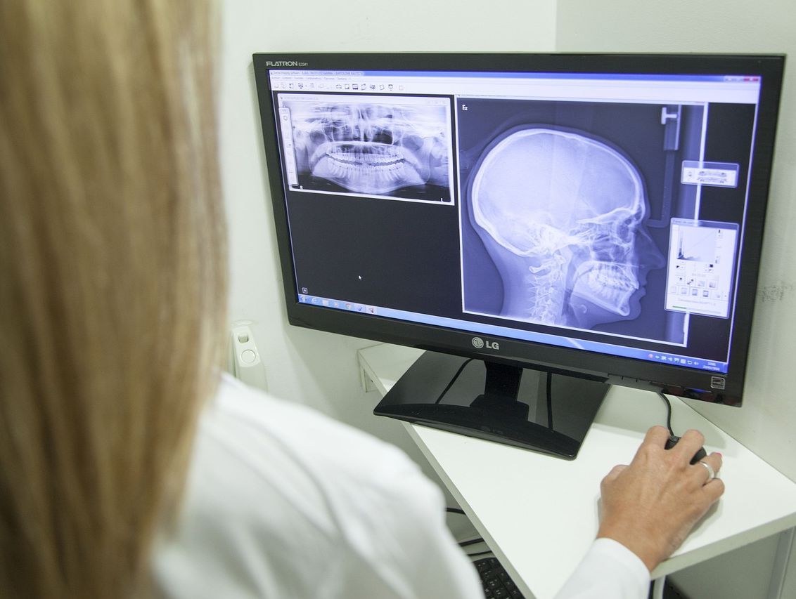 Una mujer está mirando una radiografía de un cráneo en una pantalla de computadora.