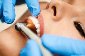 Zahnarztpraxis Stefan Gollwitzer füllungen/Inlays