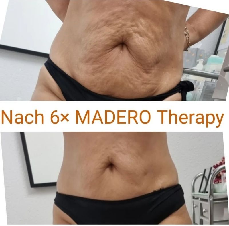 Maderotherapie nail and beauty center daniela