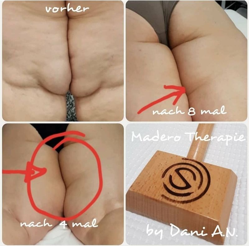 Maderotherapie nail and beauty center daniela