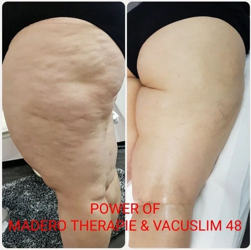 Maderotherapie nail and beauty center daniela