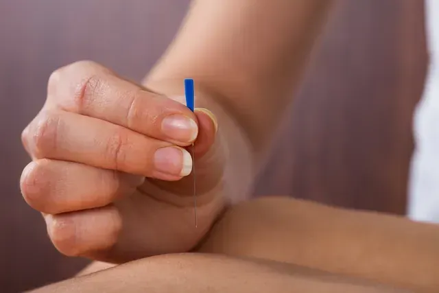 Una persona sostiene una fina aguja de acupuntura azul, preparándose para insertarla en el brazo de un paciente.