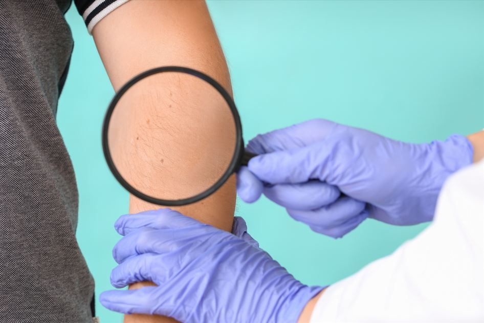 Médico examinando el brazo del paciente con lupa; guantes azules, fondo azul verdoso.