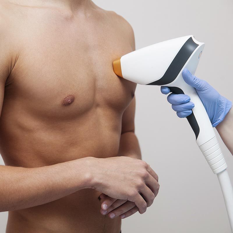 Un hombre sin camisa se está haciendo un tratamiento de depilación en el pecho.