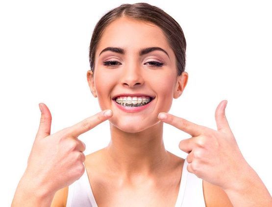 Una mujer con aparatos dentales sonríe y señala sus dientes.