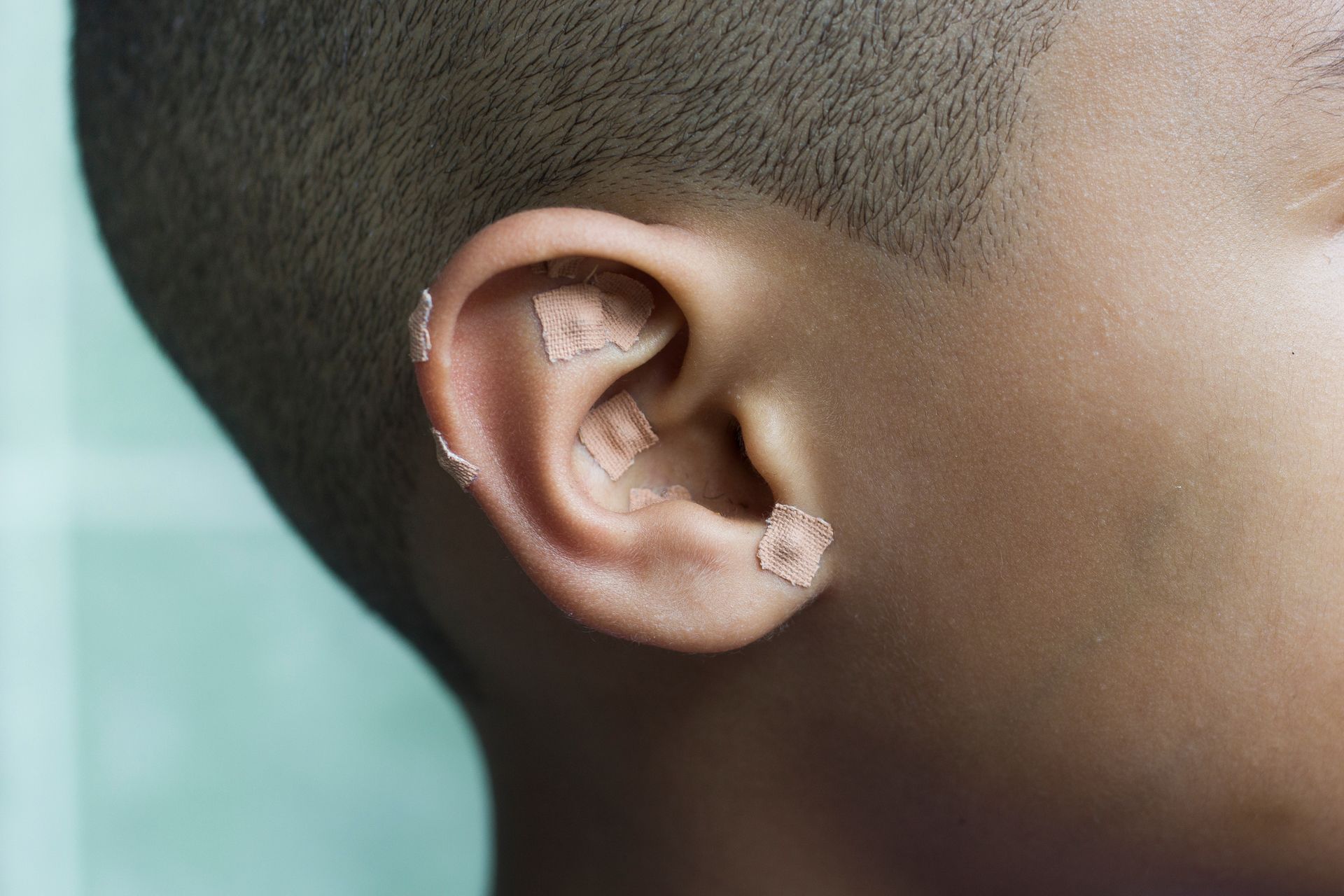 Gros plan sur l'oreille d'une personne avec des aimants sur un fond bleu clair