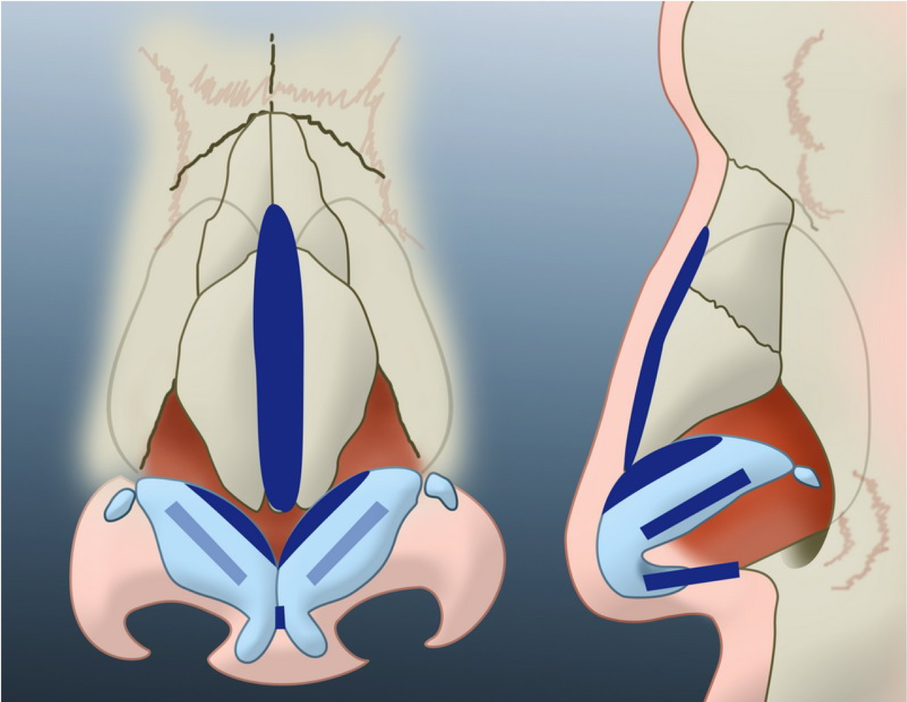 Voie respiratoire, pathologie ORL - Dr Ikonomidis