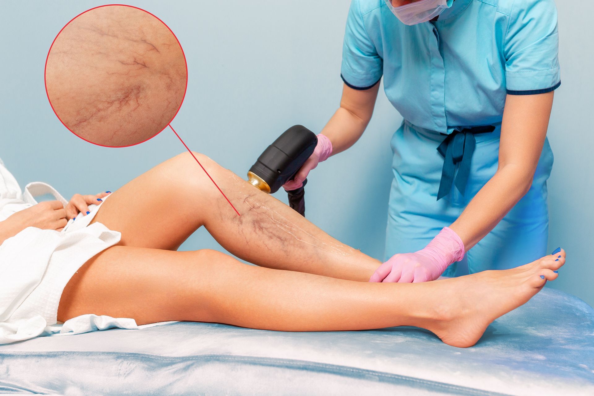 Un traitement HIFU sur les varices d'une patiente