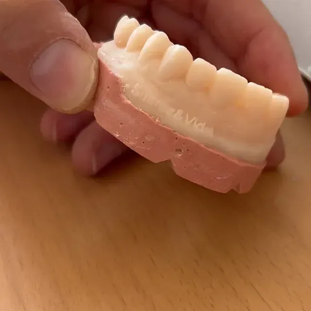 Mano sosteniendo un pequeño modelo de dientes superiores y encías, de color rosa y blanco, apoyado sobre una superficie de madera.
