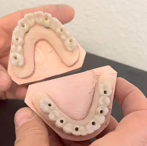 Dos manos sosteniendo dentaduras postizas superior e inferior mostrando dientes artificiales y soporte.