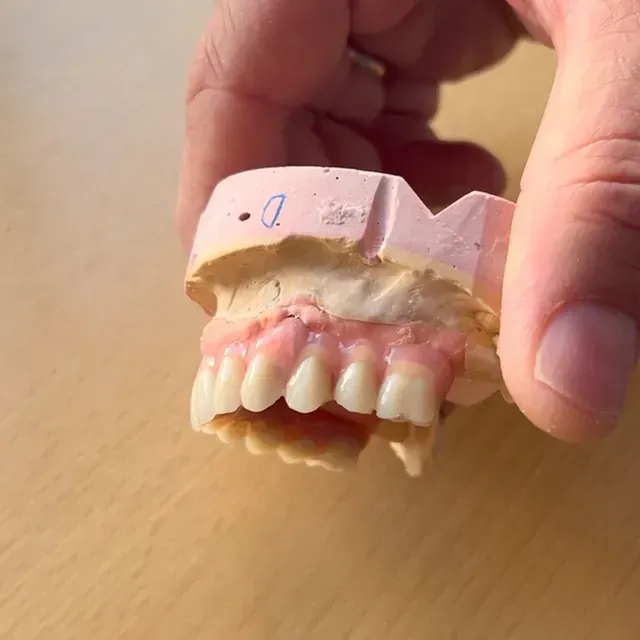 Mano sosteniendo un molde dental con encías rosadas y dientes blancos.