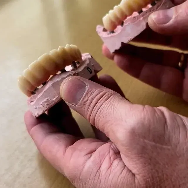 Manos sosteniendo moldes dentales con dientes.