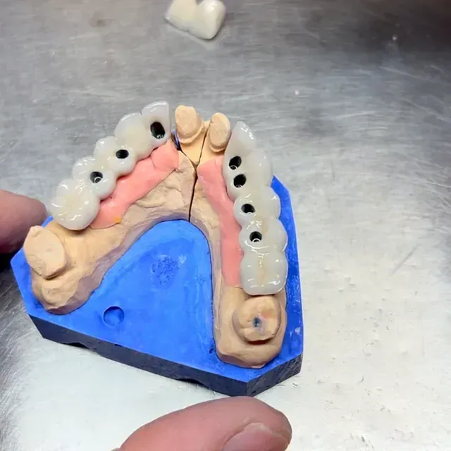 Modelo dental con dientes artificiales, varios colores, sujetados con los dedos.