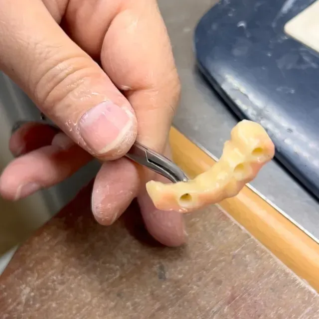 Mano que sostiene un implante dental con pinzas, mostrando el implante de color pálido y piel.