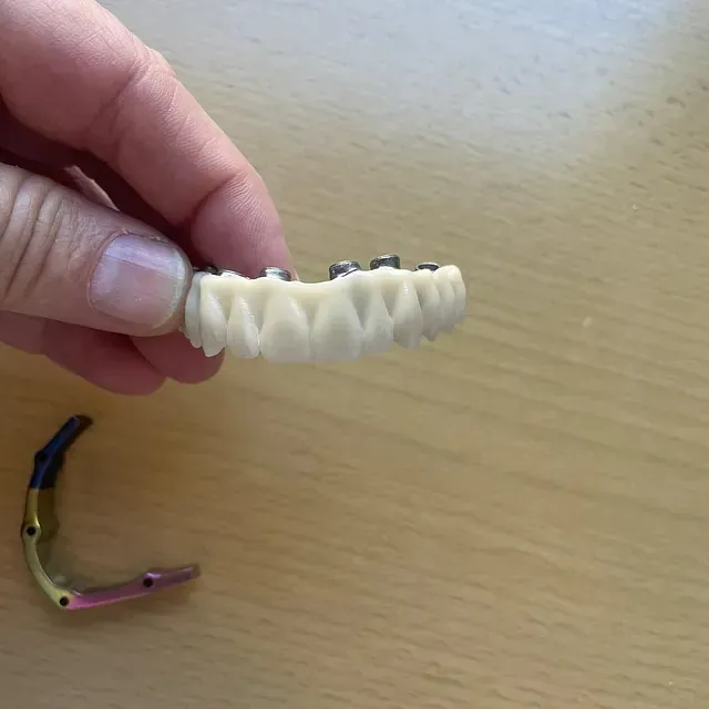 Mano sosteniendo una dentadura postiza y un mecanismo de bisagra separado sobre una superficie de madera.