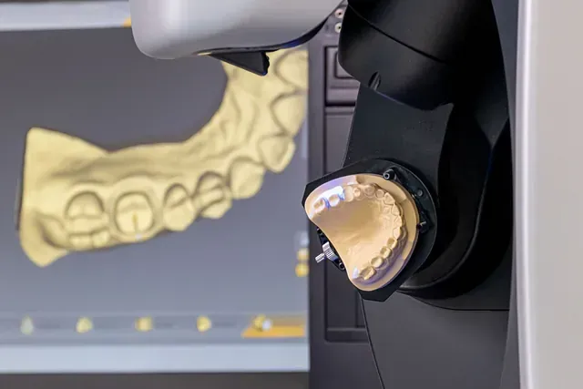 Un escáner dental que captura una impresión de los dientes y muestra un modelo 3D en una pantalla.