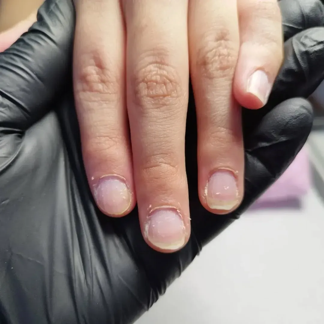 Una persona que lleva un guante negro se sujeta las uñas.