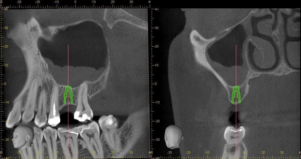 Equipo de radiología dental en Radiología Yangüela, Logroño