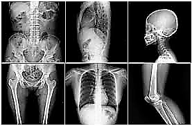 Equipo de radiografías digitales en Radiología Yangüela, Logroño