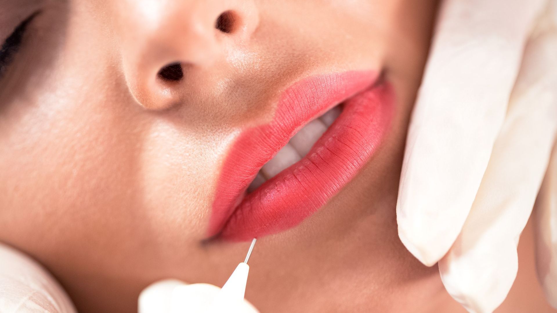 Primer plano del rostro de una persona recibiendo inyecciones en los labios. 