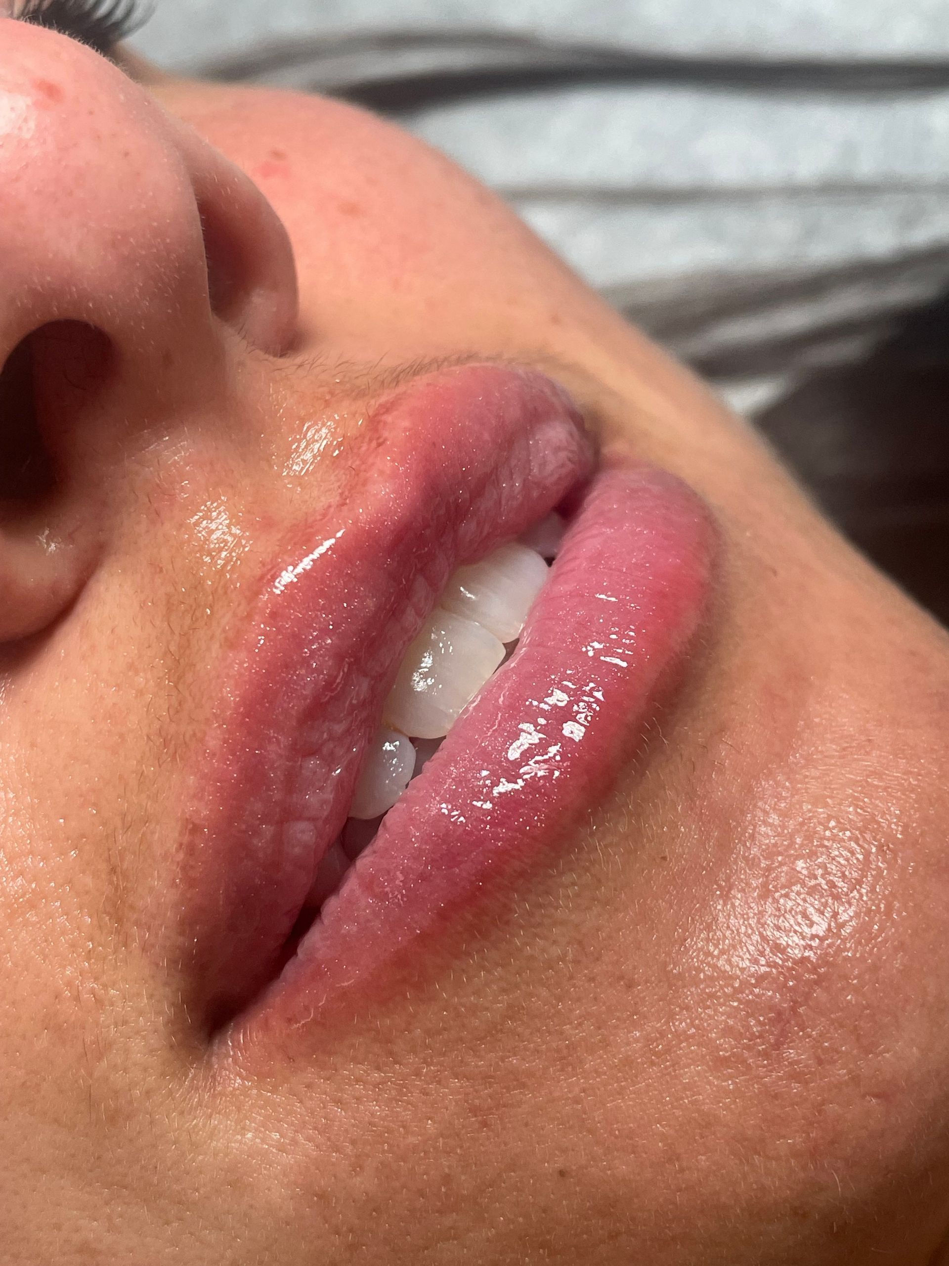 Un primer plano de los labios de una mujer con lápiz labial rosa y dientes blancos.