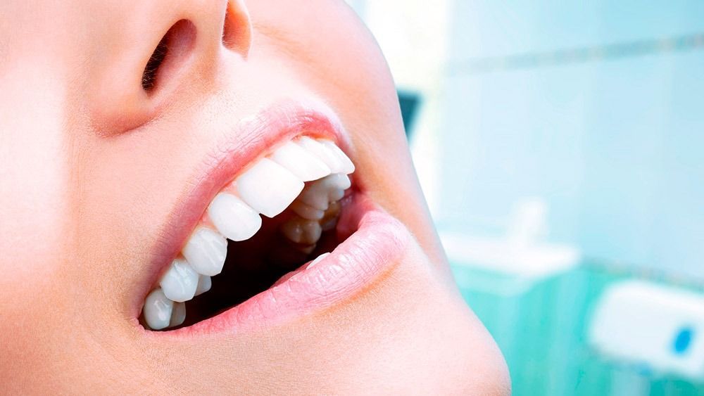 Un primer plano de los dientes de una mujer con la boca abierta.