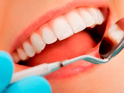 Una mujer está siendo examinada por un dentista.
